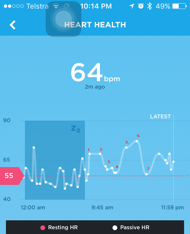 VCIX-NV Follow-up: Wearable Heart Rates and VCP Inheritance